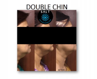 Picture2